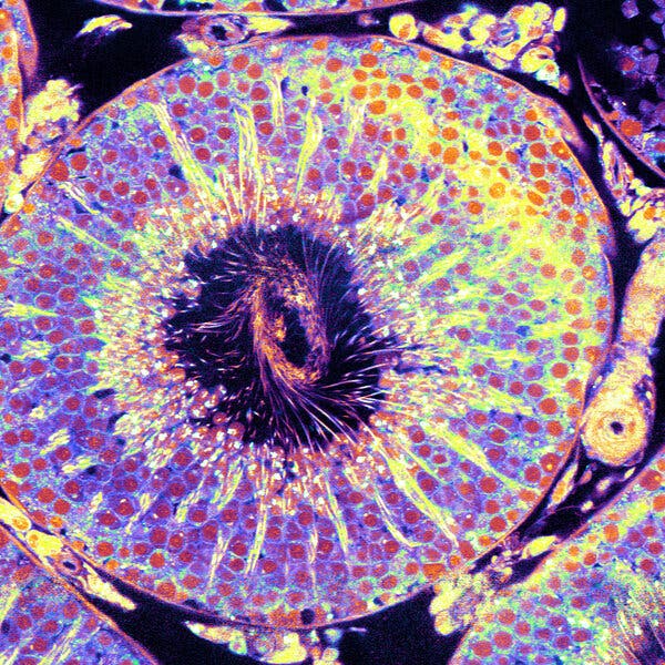 Microscopic images of sperm tails in rat testis captured by the unique NoRI microscope, offering insights that may one day advance treatments for testicular cancer.